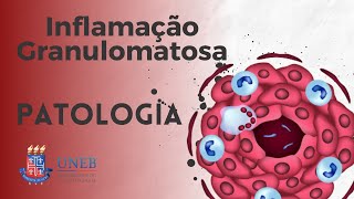 Inflamação Granulomatosa [upl. by Bowers690]