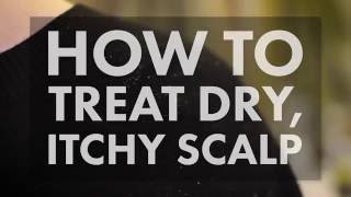 How to Treat a Dry Itchy Scalp  WebMD [upl. by Egief]