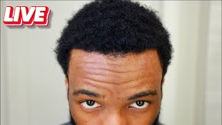 Hair Transplant Week 33 Live [upl. by Rourke]