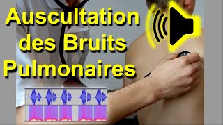 Bruits pulmonaires anormaux Auscultation Son Audio Poumon murmure vésiculaire frottement pleural [upl. by Wernsman]