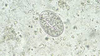 Strongyloides stercoralis egg [upl. by Uzia]