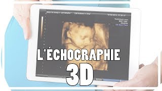 GROSSESSE Léchographie 3D  Lue Exina [upl. by Savage668]