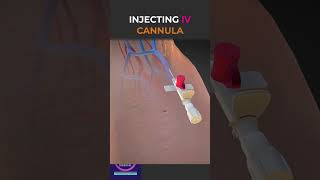 Injected IV Cannula With Sticking Plaster shorts education [upl. by Aliuqa]