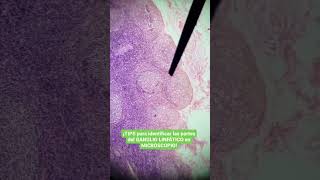 ¡TIPS para identificar las partes del GANGLIO LINFÁTICO MICROSCOPIO histología linfático [upl. by Adnolrehs]