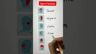 Headache के कितने types headache migraine neckpain pain headacherelief chiropractor [upl. by Anilam147]