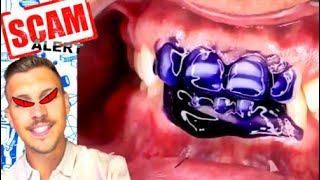 WARNING THIS TOOTH WHITENING SCAM IS GOING VIRAL ON TIKTOK [upl. by Nek]