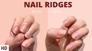 Nail Ridges The Silent Signaling Your Nails Are Trying to Tell You [upl. by Iamhaj325]