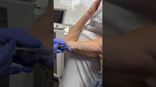 Tattoo Removal Progress Video [upl. by Blasien590]