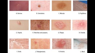 Skin Lesions with defination [upl. by Edualc]