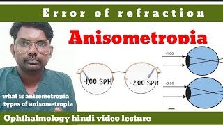 anisometropia  error of refraction  what is anisometropia  anisometropia  optometryhindi [upl. by Bertasi]