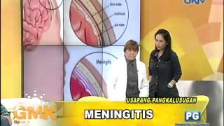 What is Meningitis [upl. by Ximenes312]