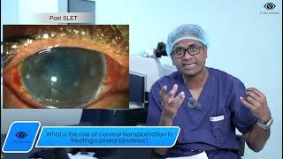 What is the role of corneal transplantation in treating corneal blindness [upl. by Ahset]