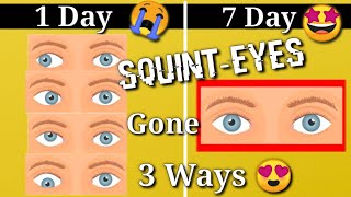 Squint Eye correction NATURALLY with exercises at Home [upl. by Garey516]