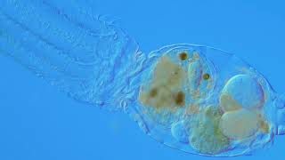 Rotifers Stephanoceros fimbriatus and Synchaeta pectinata DIC microscopy [upl. by Lemart55]