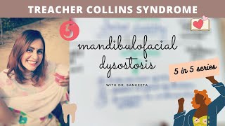 treacher collins syndrome [upl. by Monia553]