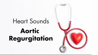 Heart Murmurs and Heart Sounds [upl. by Ainat]