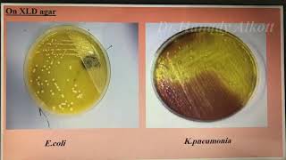 🤓🥳Enterobacteriaceae العملي 🤓😷 [upl. by Eteragram]