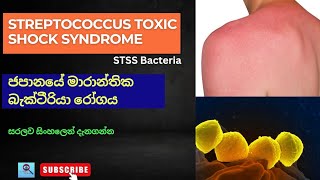 Streptococcus Toxic Shock Syndrome  STSS Bacteria  මාරාන්තික බැක්ටීරියා රෝගය stss streptococcus [upl. by Atelahs]