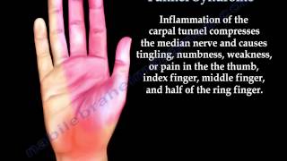 Anatomy of Carpal Tunnel Syndrome  Everything You Need To Know  Dr Nabil Ebraheim [upl. by Hubert]