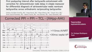 Taquicardias supraventriculares [upl. by Nilya]