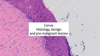 Cervical pathology part 1 [upl. by Eiro]