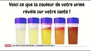 COMMENT TRAITER LES INFECTIONS URINAIRES [upl. by Nosreve791]