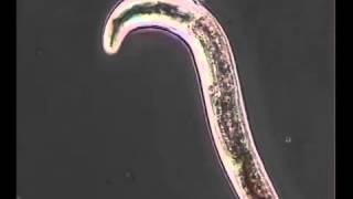 Nematodo Meloidogyne [upl. by Schoof]