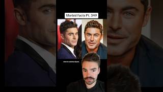 WHAT happened to Zac Efron’s jaw morbidfacts [upl. by Allimak270]