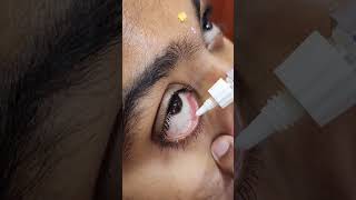 Simple Steps to Apply Eye Ointment eyeawareness eyeclinic mogappair ophthalmologist eyecare [upl. by Eiro]