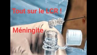 Etude cytobactériologique du LCR  différents aspect du LCR [upl. by Ydnis]