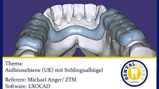 EXOCAD TUTORIAL  Aufbissschiene UK mit Sublingualbügel [upl. by Apgar794]