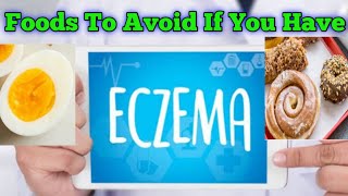 10 Foods You must Avoid When Suffering From Eczema  Healthy N Happy Life eczemadiet foodallergies [upl. by Legim560]