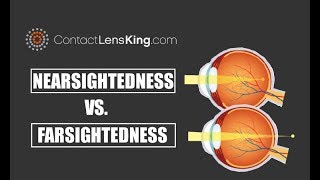 Nearsightedness Vs Farsightedness and the Difference Between the Two [upl. by Nanam]