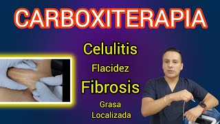 Carboxiterapia  Celulitis flacidez fibrosis Grasa Localizada  Aplicación [upl. by North]