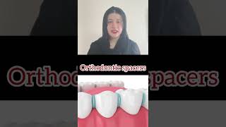 Orthodontic spacers dentistteeth doctor duet space [upl. by Rivera]