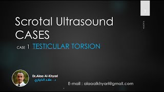 Case 1  Testicular Torsion  Emergency case [upl. by Nihhi706]