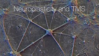 Unlocking Neuroplasticity TMS ECT and Deep Brain Stimulation Explained [upl. by Katharina876]