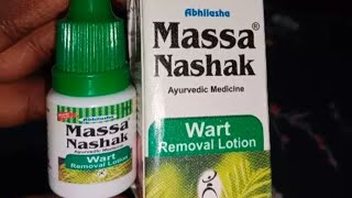 Massa Nashak Wart Removal Cream Information And Review In Hindi [upl. by Mayhs]