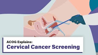 ACOG Explains Cervical Cancer Screening [upl. by Cicely]