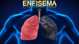 ENFISEMA  MEDICINA HUMANA  MediCiencia [upl. by Eirallam]