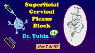 Superficial Cervical Plexus Block  Landmarkguided technique  Cervical Plexus Block  SCPB [upl. by Kreis]