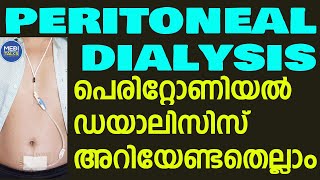 Peritoneal Dialysis details in malayalam  peritoneal dialysis treatment [upl. by Semaj]