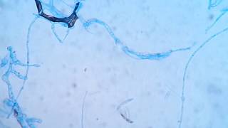 Fusarium solani in LPCB mount Showing Micronidia on long PhialidesMacronidia and Chlamydospores [upl. by Ssenav]