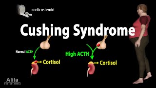 Cushing Syndrome Animation [upl. by Phillie996]