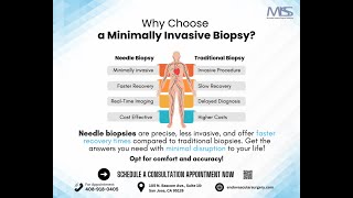 Why Choose a Needle Biopsy [upl. by Sieber]