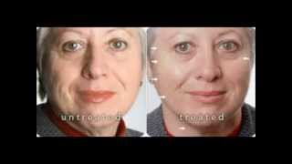 Nu Skin AgeLoc Galvanic Spa Before and After Photos [upl. by Kilbride165]