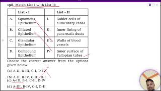 Match List I with List II  List  I List – II A Squamous Epithelium I Goblet cells of alimentary [upl. by Salvadore661]