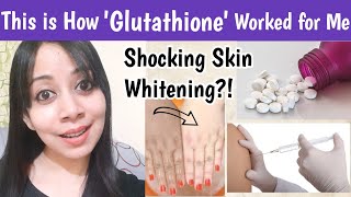 Glutathione Works for Skin Whitening For Tan removal Pigmentations Glutathione before and after [upl. by Yerbua633]