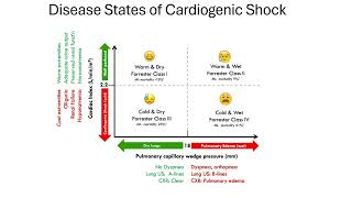 cardiogenic shock [upl. by Lauber]