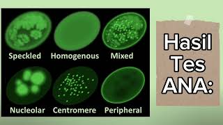 ANA Antinuclear Antibody Test [upl. by Marven]